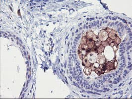 SDS Antibody (clone OTI3D3)