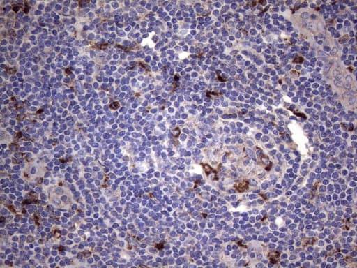 CD68 Antibody (clone KP1)