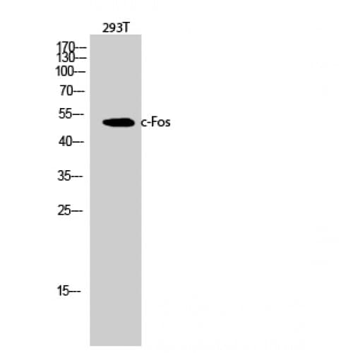 Polyclonal Rabbit anti-Human FOS / c-FOS Antibody (300-380 aa, IHC, WB)