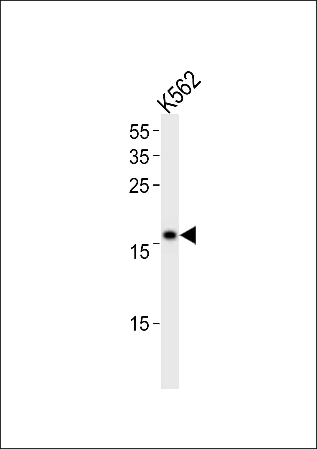POLE3 / DNA Polymerase Epsilon Antibody (aa5-34)