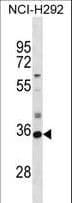 SULT2A1 / Sulfotransferase 2A1 Antibody (aa2-30)