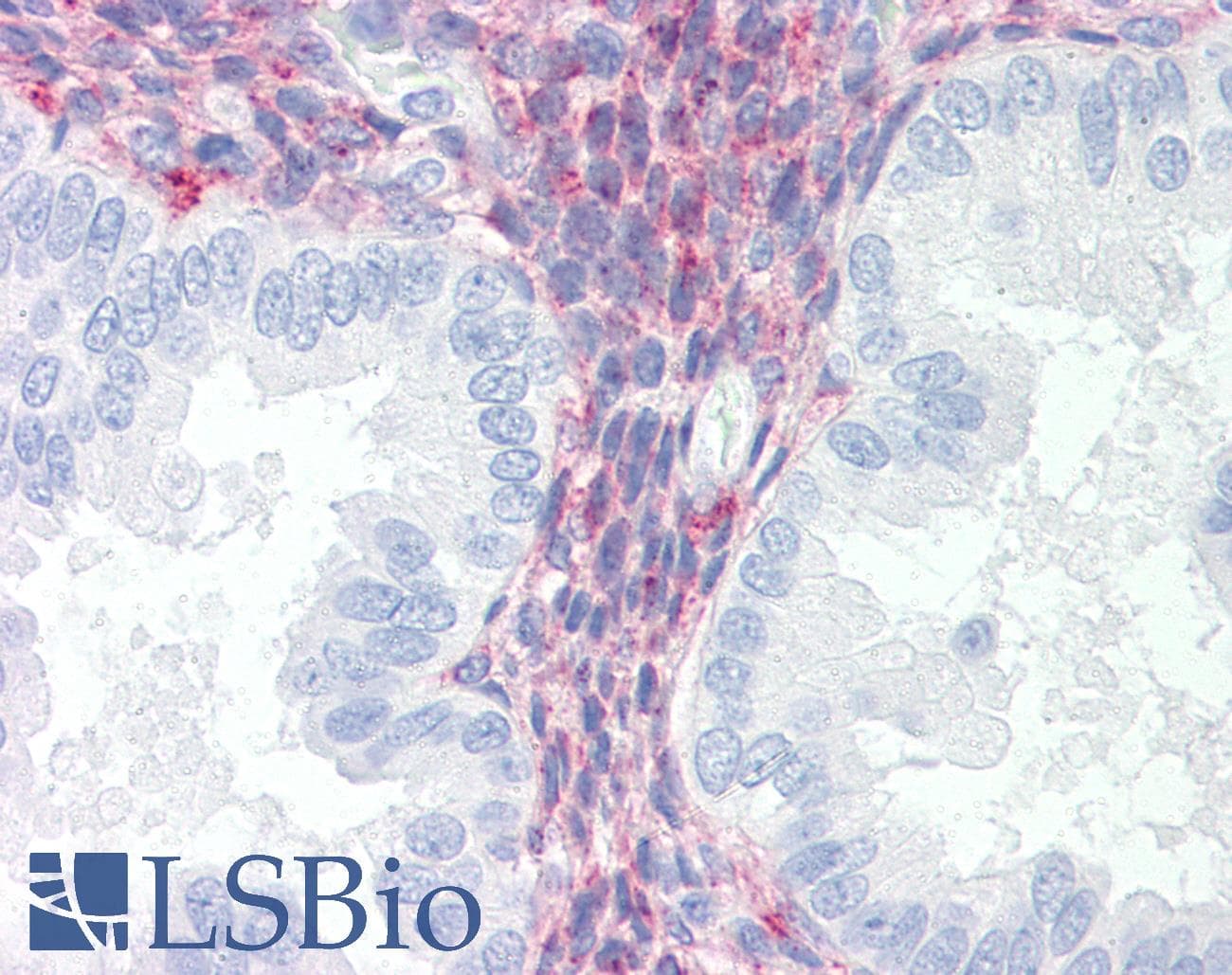 IHC-plus™ LRP1 / CD91 Antibody (clone A2Mralpha-2, Azide-free)