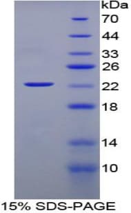 Rat IFNA / Interferon Alpha Protein (Recombinant His, N-Terminal)