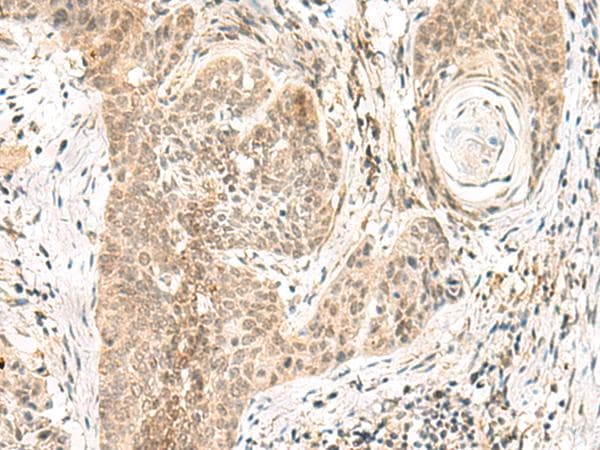 Polyclonal Rabbit anti-Human GPSM1 / AGS3 Antibody (IHC)
