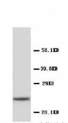 PathPlus™ CRP / C-Reactive Protein Antibody (N-Terminus)