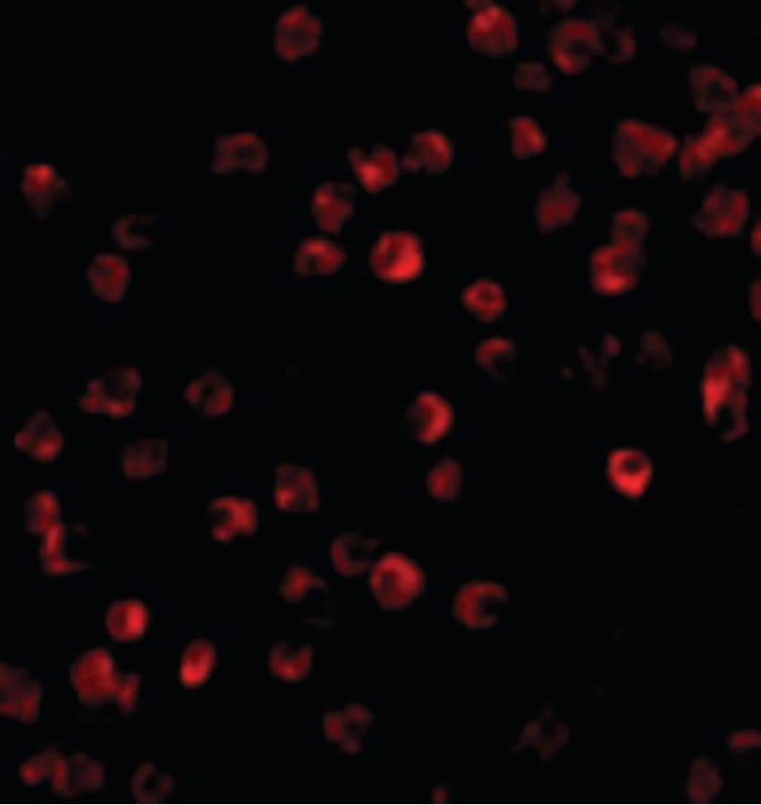 BTK Antibody
