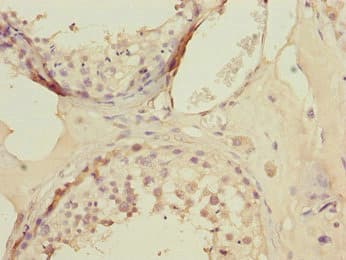 BTEB / KLF9 Antibody