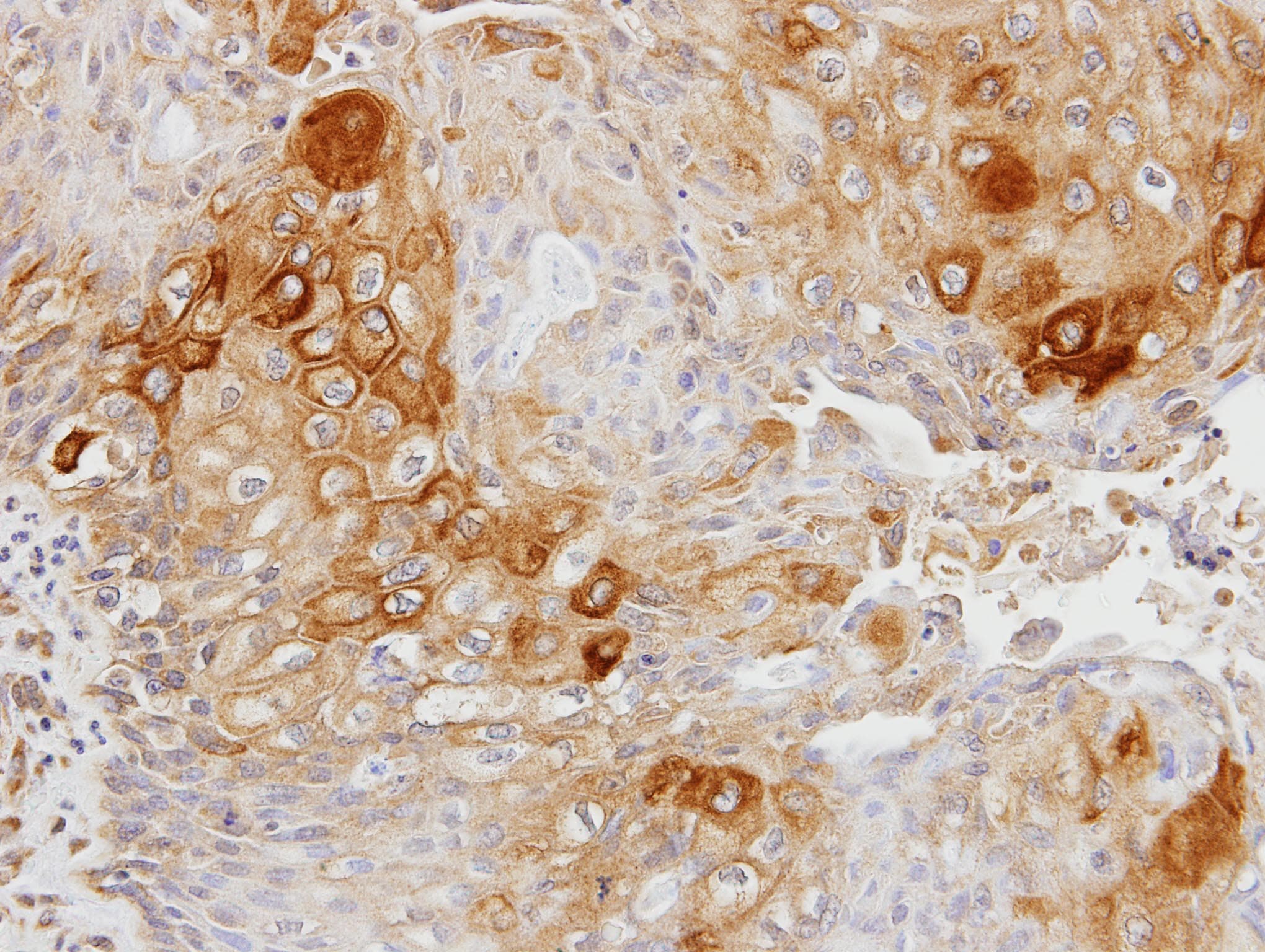 GK2 / Glycerol Kinase 2 Antibody (aa67-338)