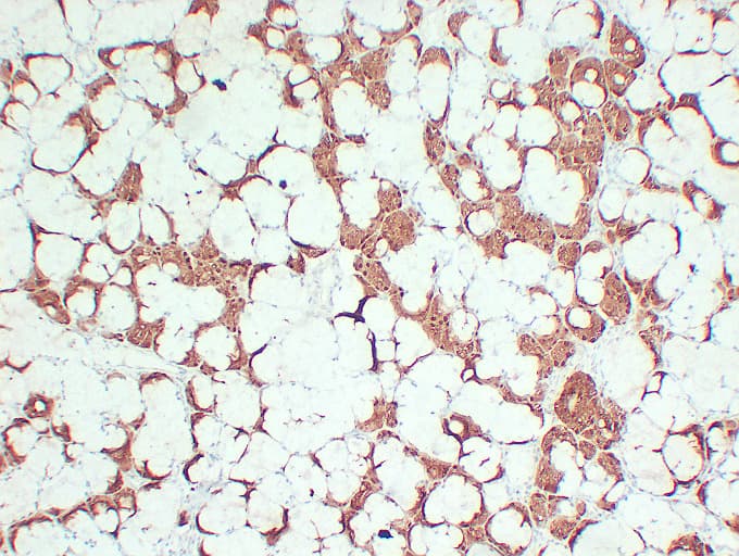 Monoclonal Mouse anti-Human S100A1 / S100-A1 Antibody (clone ABT-S100A1, IHC)