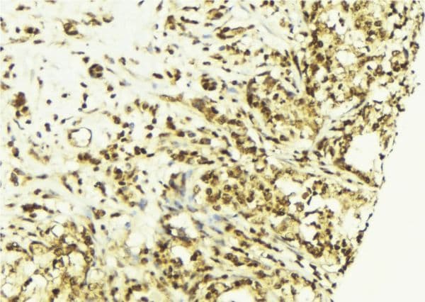 MYC / c-Myc Antibody
