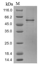 Mouse SRPX2 Protein (Recombinant 10His, N-terminus + Myc, C-terminus)