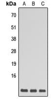 Polyclonal Rabbit anti-Human GNG5 Antibody (N-Terminus, WB)