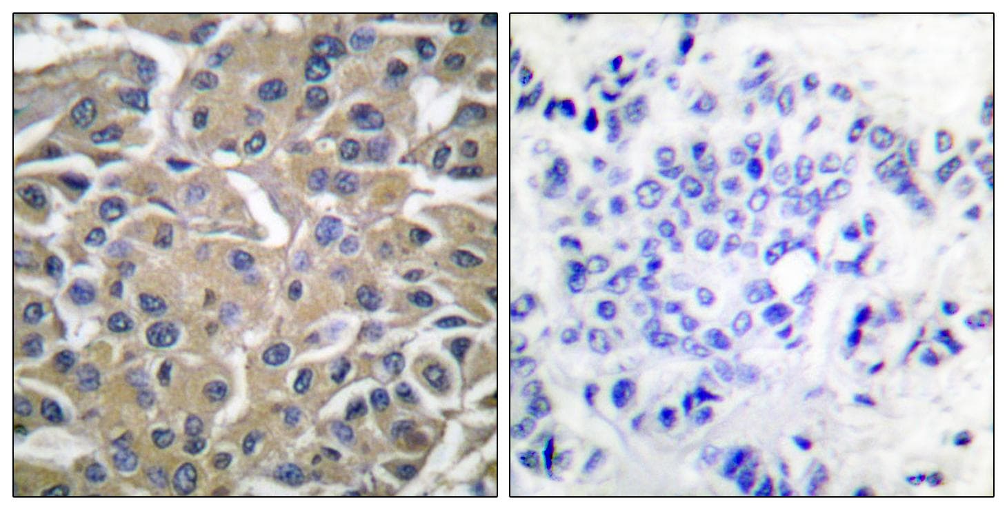 SYK Antibody (phospho-Tyr525)