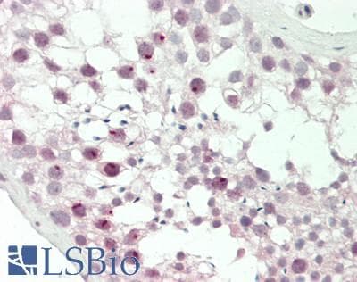 IHC-plus™ BAF53B / ACTL6B Antibody (aa42-70)