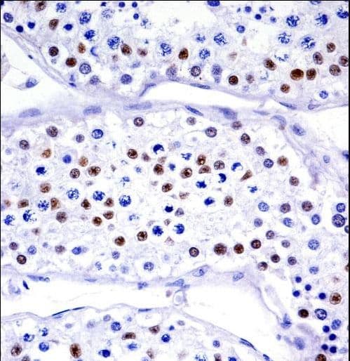 UBA1 / UBE1 Antibody (aa1-30)