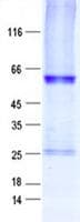 Human DTX3 Protein (Recombinant GST, N-terminus + His, C-terminus)