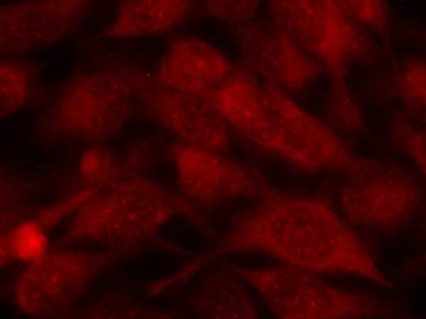 PathPlus™ STMN1 / Stathmin / LAG Antibody (Ser37)