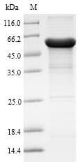Human AADAC Protein (Recombinant 10His-SUMO, N-terminus + Myc, C-terminus)
