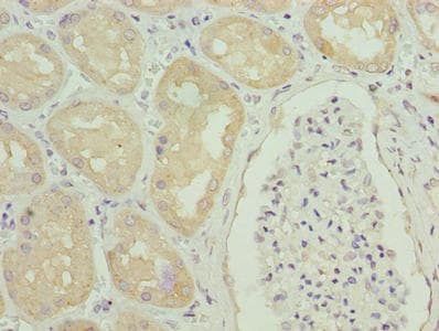 Polyclonal Rabbit anti-Human GGTLA4 / GGTLC1 Antibody (IHC)
