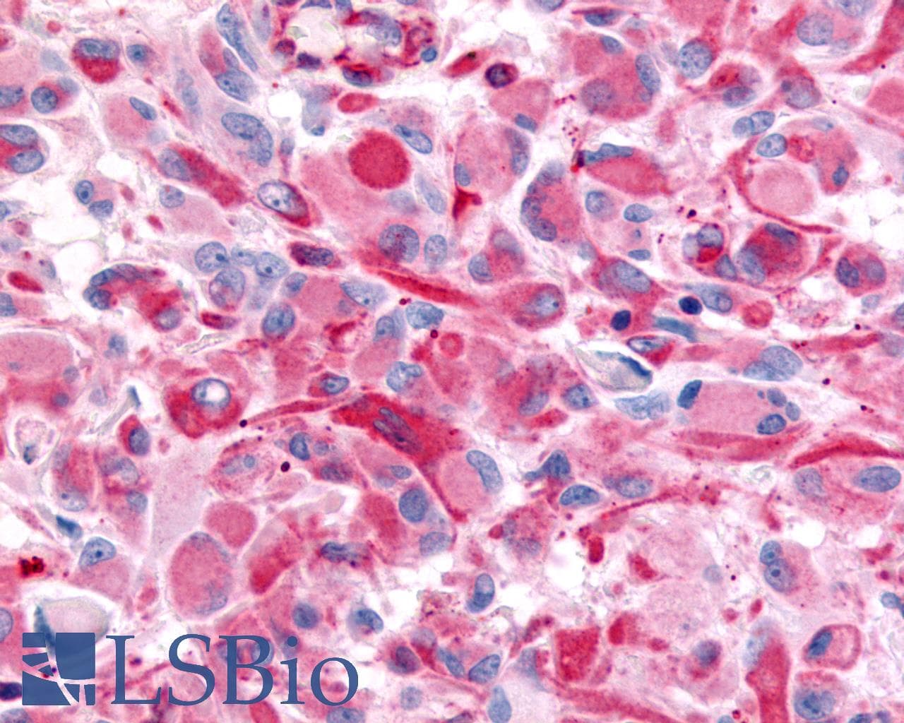 PathPlus™ Polyclonal Rabbit anti-Human CHRM2 / M2 Antibody (Cytoplasmic Domain, IHC)