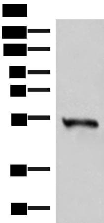 FAM134B Antibody