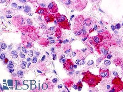 PathPlus™ GPR12 Antibody (C-Terminus)
