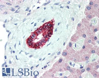 IHC-plus™ Polyclonal Rabbit anti-Human CA9 / Carbonic Anhydrase IX Antibody (IHC, WB)