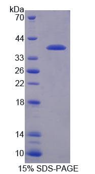 Mouse RGS9 Protein (Recombinant)