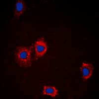 AKT1 + AKT2 + AKT3 Antibody (Internal)