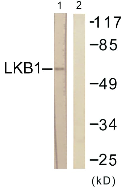 STK11 / LKB1 Antibody (aa155-204)