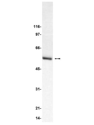 PathPlus™ TUBB3 / Tubulin Beta 3 Antibody (aa436-450)