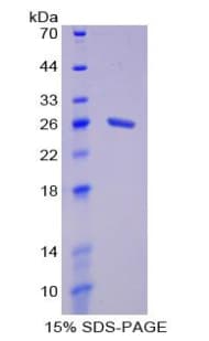 Mouse MPHOSPH6 Protein (Recombinant His-T7)