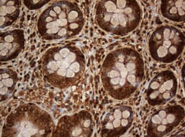 PAI-RBP1 / SERBP1 Antibody (aa1-262, clone OTI1E7)