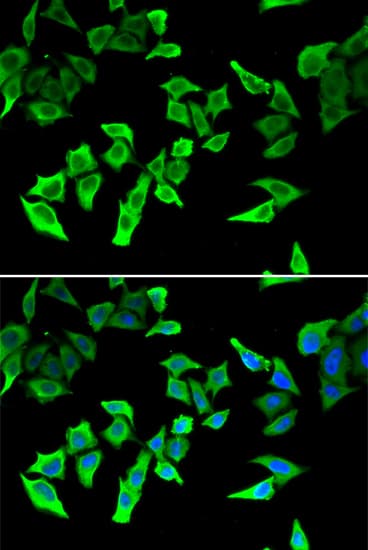 MLH1 Antibody