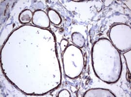 CD30 Antibody (clone OTI16H5)
