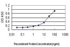 IHC-plus™ Monoclonal Mouse anti-Human SSR1 Antibody (clone 1A12, IHC, WB)