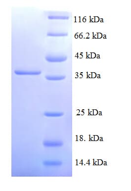 Human NDUFA3 / B9 Protein (Recombinant GST)