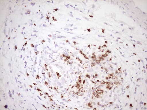 TFPI / LACI Antibody (aa29-304, clone OTI5H5)