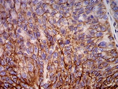 Monoclonal Mouse anti-Human HLA-B Antibody (clone 2G7B10, IHC, IF, WB)