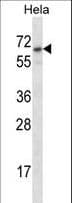 Polyclonal Rabbit anti-Human STS / ASC / Steroid Sulfatase Antibody (aa488-517, IHC, WB)