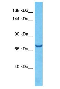 SEMA3B / SemA Antibody (aa201-250)