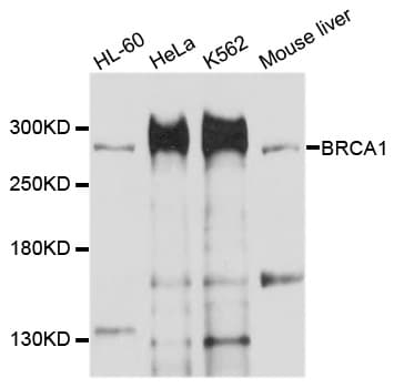 BRCA1 Antibody