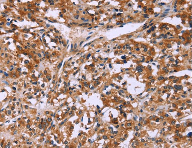 Polyclonal Rabbit anti-Human LAMP2 / CD107b Antibody (IHC)