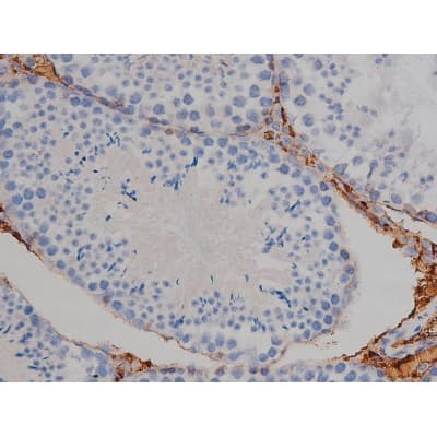 MAPT / Tau Antibody (phospho-Ser356)