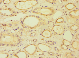 Polyclonal Rabbit anti-Human BRCC3 / BRCC36 Antibody (aa1-316, IHC, WB)