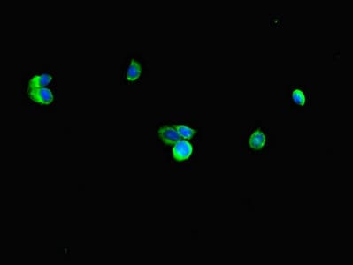 Polyclonal Rabbit anti-Human RNF4 Antibody (IHC, IF)