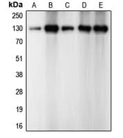 CDH2 / N Cadherin Antibody (C-Terminus)