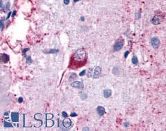 PathPlus™ CELSR2 Antibody (N-Terminus)