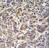 SOWAHC / ANKRD57 Antibody (aa479-507)