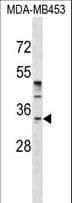 Polyclonal Rabbit anti-Human POU6F1 / BRN5 Antibody (aa56-85, WB)